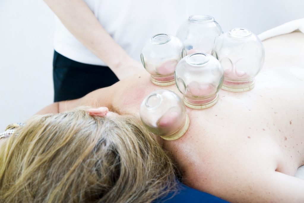 cupping therapy, cupping massage, massage-6604217.jpg